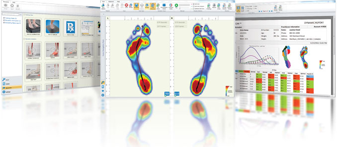 Gait Scan Analysis Brisbane