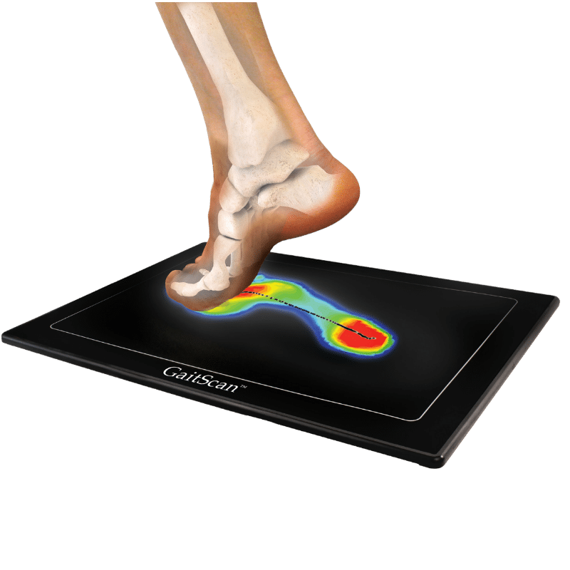 Gait Scan Analysis Brisbane